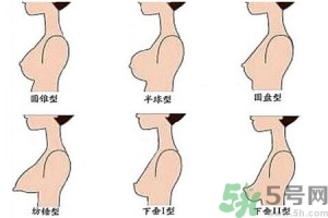 ​女性乳房下垂的真相是什么？女性乳房下垂的分类有哪些？