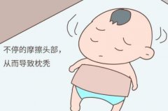 佝偻病是缺钙吗