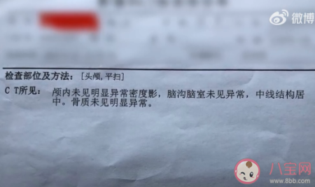 女子左眼瞳孔变大2倍找不到病因 瞳孔变大了会怎么样