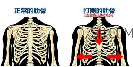 小腹突出真相是这样的_和肋骨有关吗