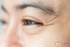 说衰老从眼睛开始 怎么保护眼部周围皮肤
