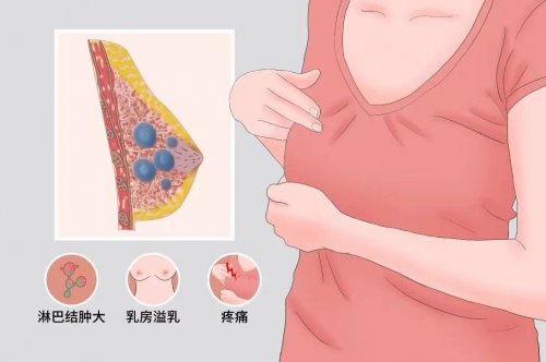 呵护乳房健康消除乳腺结节从日常做起