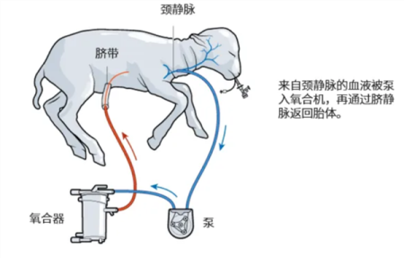 飙上热搜的人造子宫 真的能让男人也怀孕？