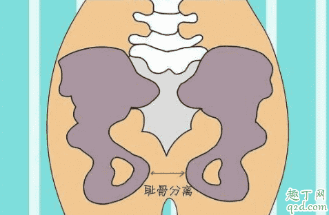 孕期为什么下边的骨头疼 孕晚期下腹部疼痛是入盆了吗5